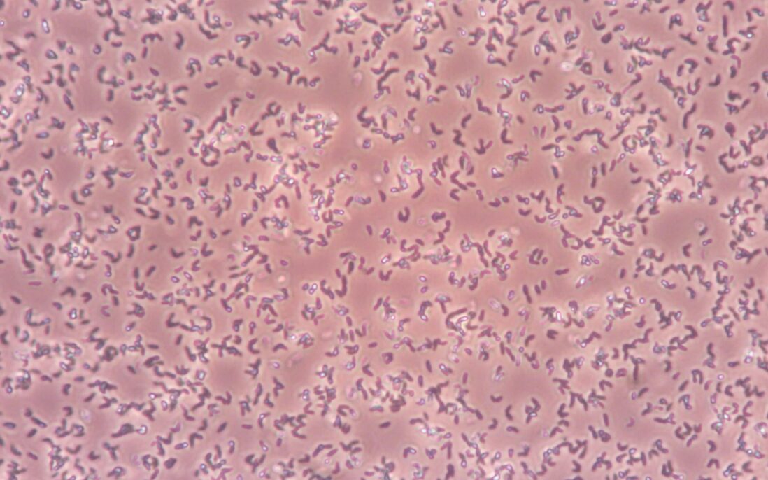 Mikroskopbilde av den aminosyreproduserende mikroorganismen Corynebacterium glutamicum under dyrkning i et medium som inneholder hydrolysert mesk.